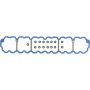 Autopart International Valve Cover Gasket Set 2000481861