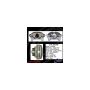 CENTRIC PARTS 141.33166 Centric Semi-Loaded Brake Caliper