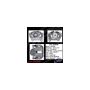 CENTRIC PARTS 141.33648 Centric Semi-Loaded Brake Caliper EPB