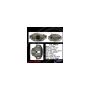 CENTRIC PARTS 141.34018 Centric Semi-Loaded Brake Caliper