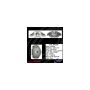 CENTRIC PARTS 141.34136 Centric Semi-Loaded Brake Caliper