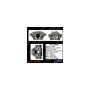 CENTRIC PARTS 141.35068 Centric Semi-Loaded Brake Caliper