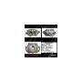 CENTRIC PARTS 141.35103 Centric Semi-Loaded Brake Caliper