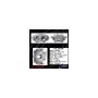 CENTRIC PARTS 141.35188 Centric Semi-Loaded Brake Caliper