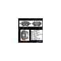 CENTRIC PARTS 141.35224 Centric Semi-Loaded Brake Caliper