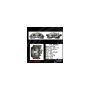 CENTRIC PARTS 141.35582 Centric Semi-Loaded Brake Caliper