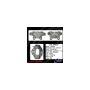 CENTRIC PARTS 141.35625 Centric Semi-Loaded Brake Caliper