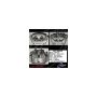 CENTRIC PARTS 141.39032 Centric Semi-Loaded Brake Caliper