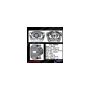 CENTRIC PARTS 141.39546 Centric Semi-Loaded Brake Caliper EPB