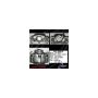 CENTRIC PARTS 141.40015 Centric Semi-Loaded Brake Caliper