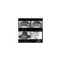 CENTRIC PARTS 141.44021 Centric Semi-Loaded Brake Caliper