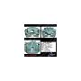 CENTRIC PARTS 141.44128 Centric Semi-Loaded Brake Caliper