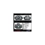 CENTRIC PARTS 141.44248 Centric Semi-Loaded Brake Caliper