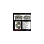 CENTRIC PARTS 141.44587 Centric Semi-Loaded Brake Caliper