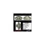 CENTRIC PARTS 141.46013 Centric Semi-Loaded Brake Caliper