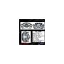 CENTRIC PARTS 141.51006 Centric Semi-Loaded Brake Caliper