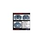 CENTRIC PARTS 141.51258 Centric Semi-Loaded Brake Caliper