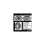 CENTRIC PARTS 141.51276 Centric Semi-Loaded Brake Caliper