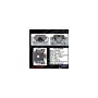 CENTRIC PARTS 141.51646 Centric Semi-Loaded Brake Caliper with New Phenolic Pistons